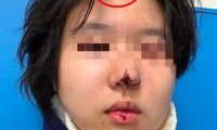 夜晚犯罪太猖獗！洛杉矶华人学生遭随机枪击 头破血流 公布经历遭恶言围攻